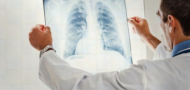 Tütünle mücadele akciğer kanserini azalttı