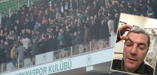 Trabzon maçında kaşı açılan eski yönetici konuştu