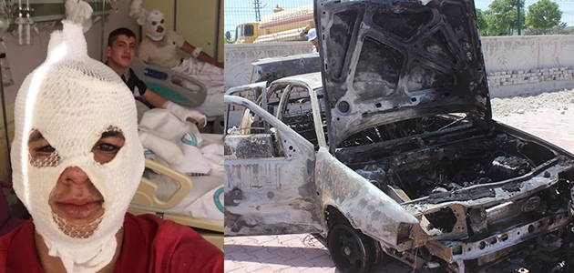 Konya’da seyir halindeki otomobil yandı: 5 yaralı