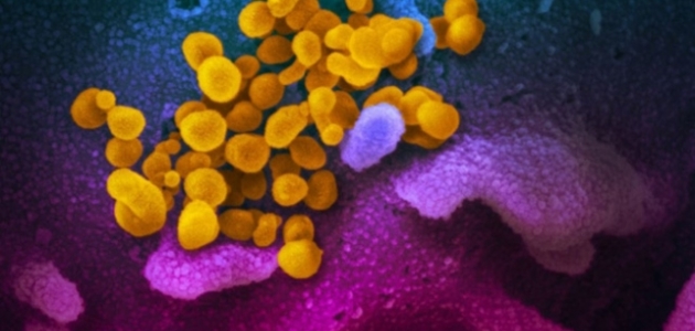 Dünyada koronavirüs bulaşan kişi sayısı 76 bin 700’ü aştı