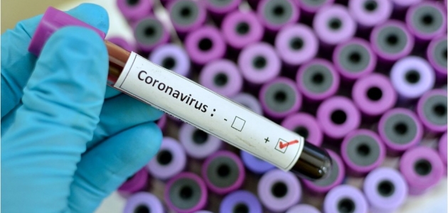 Japonya korona virüsüne karşı grip ilacını kullanmaya hazırlanıyor