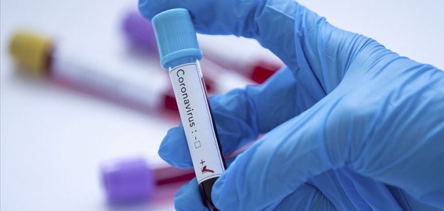 Bulgaristan’da 4 kişide yeni tip koronavirüs tespit edildi
