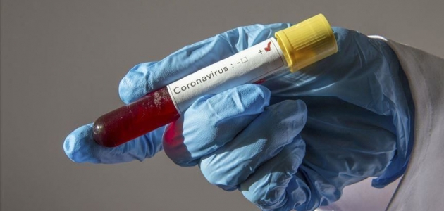 Gabon’da ilk koronavirüs vakası görüldü