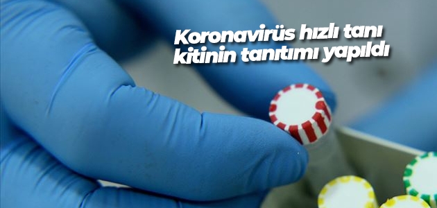 Koronavirüs hızlı tanı kitinin tanıtımı yapıldı