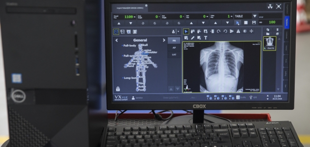 Yerli üretim röntgen makineleri göreve hazır
