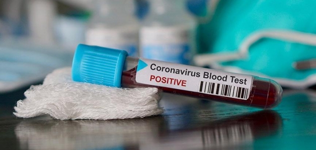 Koronavirüs testlerinde ’yalancı negatifliklere’ dikkat