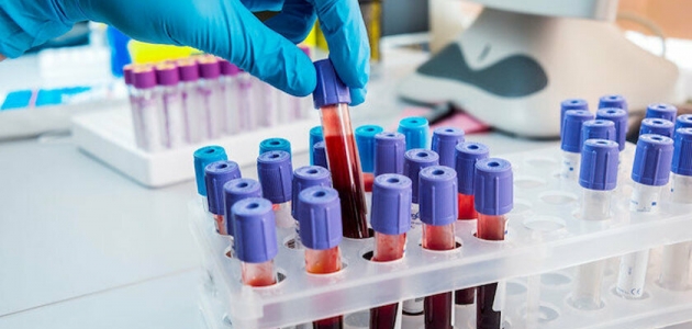 Koronavirüs testlerinde yeni dönem: Salgını geçirip iyileşen kişiler belli olacak