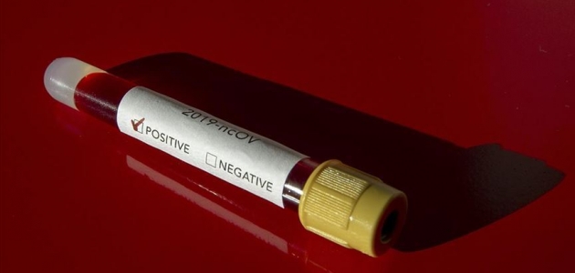 Koronavirüsle mücadele yeni yöntem: Riskli gruba düzenli test