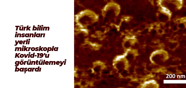 Türk bilim insanları yerli mikroskopla Kovid-19’u görüntülemeyi başardı