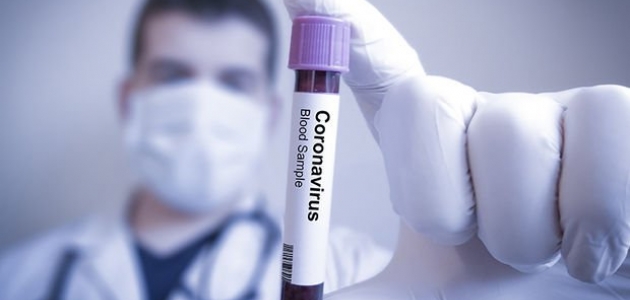 Koronavirüs tespit edilen kişi sayısı 21 milyon 827 bini geçti