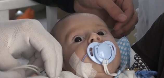 SMA hastası Ali bebek yaşam mücadelesini kaybetti