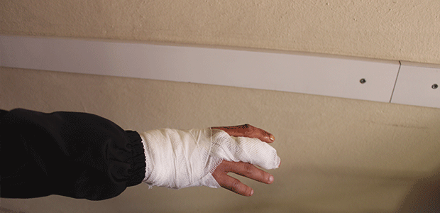 Karapınar’da sokak köpeğinin saldırdığı genç yaralandı