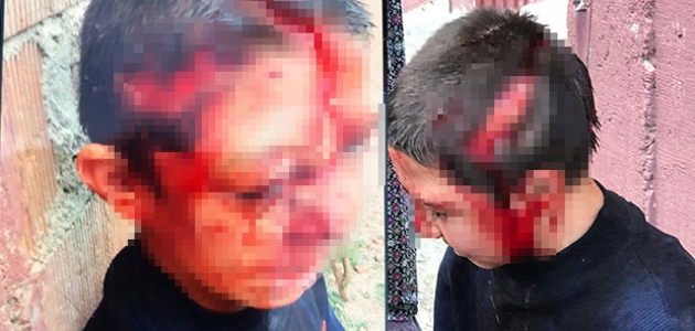 Köpeğin saldırısına uğrayan çocuk ölümden döndü