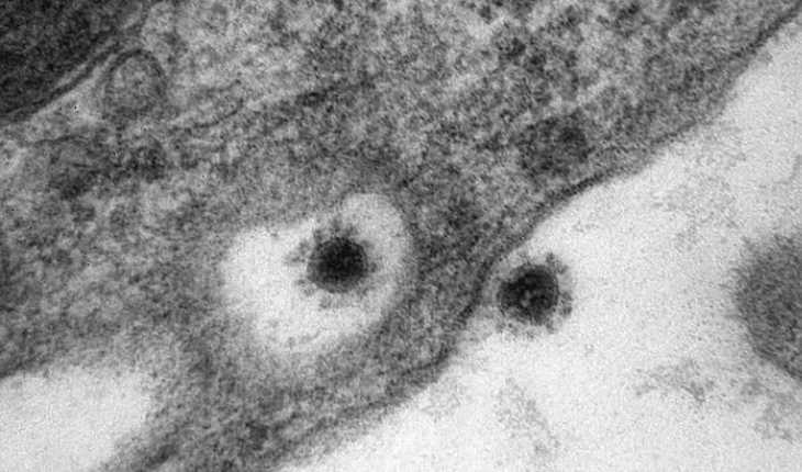 Corona virüsün Delta Plus mutasyonu görüntülendi