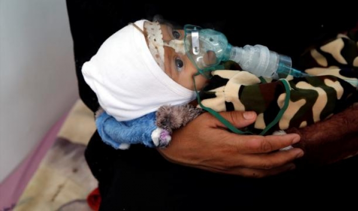 DSÖ Yemen'de yeterli beslenemeyen 18 bin çocuk için program başlattı