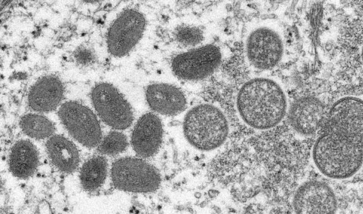 Maymun çiçeği virüsü yayılmayı sürdürüyor