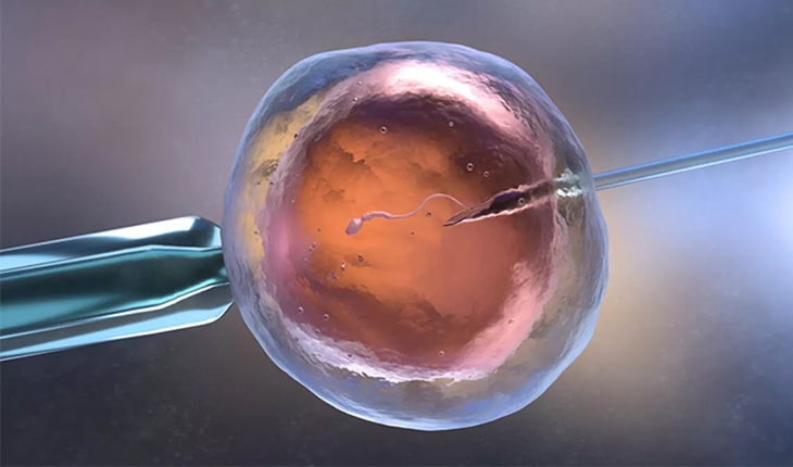 Yapay Zeka İle Tüp Bebek Tedavisi Novafertil İle Konya’da