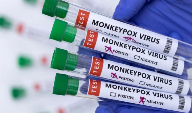 Küresel maymun çiçeği vakaları yüzde 20 arttı