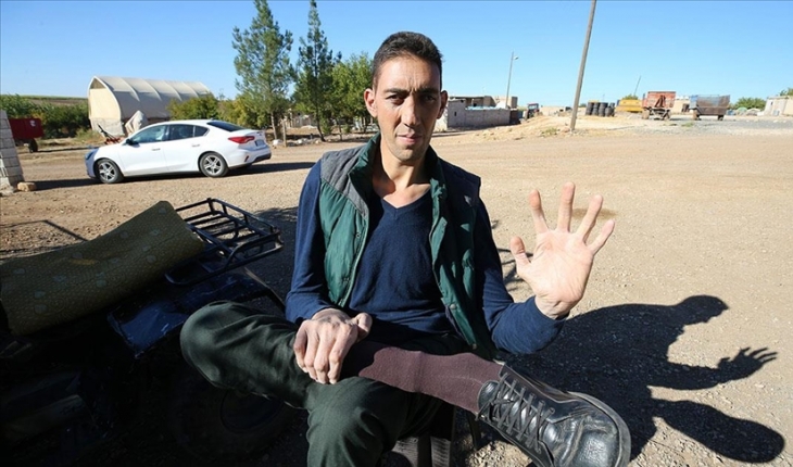 "Dünyanın en uzun adamı" Sultan, Türkiye'yi Romanya ve ABD'de temsil edecek