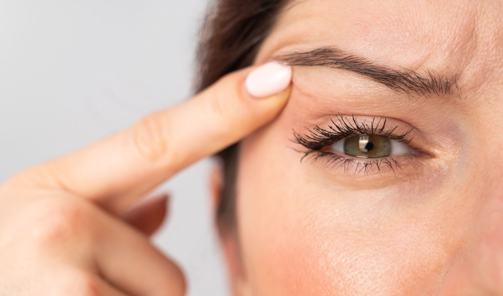 Göz Kapağı Düşüklüğü Tedavisi Nasıl Yapılır?