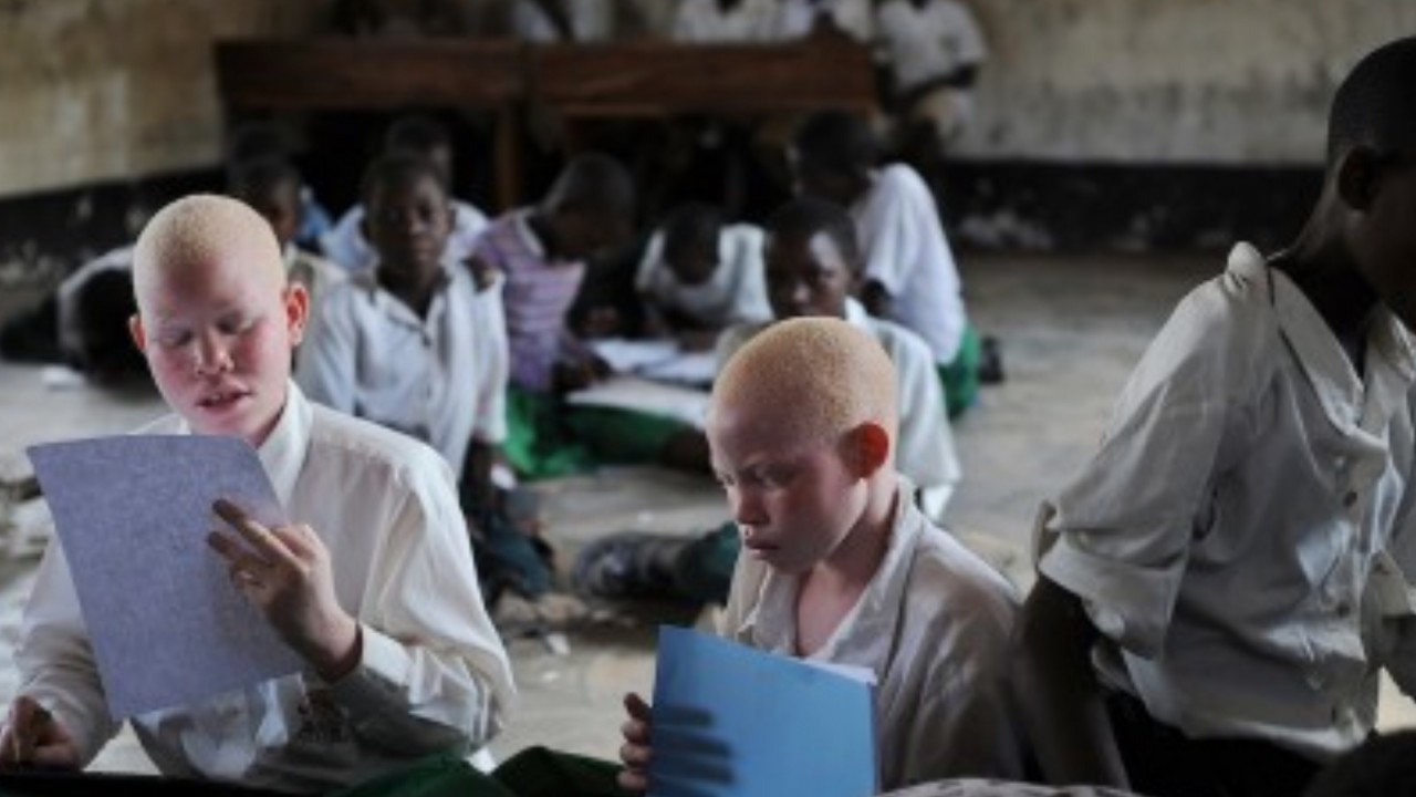 Mozambik'te büyücülükte kullanılması amacıyla albinos bir adamın cesedi çalındı