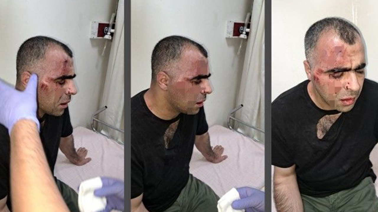 Gazeteciye saldırı: Belediye çalışanı ile bir polis açığa alındı