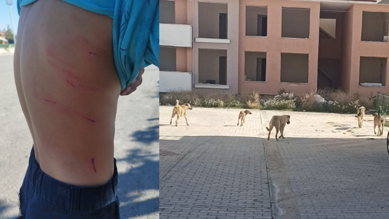 Konya’da 8 yaşındaki çocuğa sokak köpekleri saldırdı