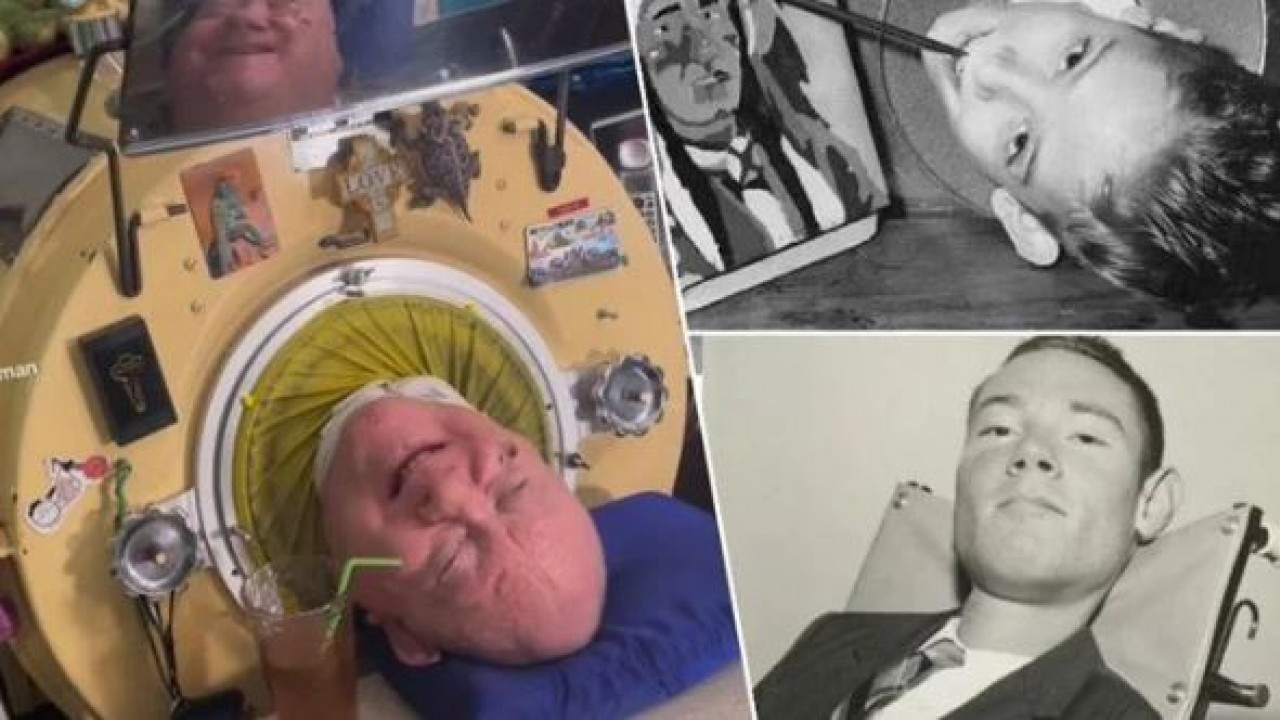 'Demir akciğerli adam' 78 yaşında hayatını kaybetti