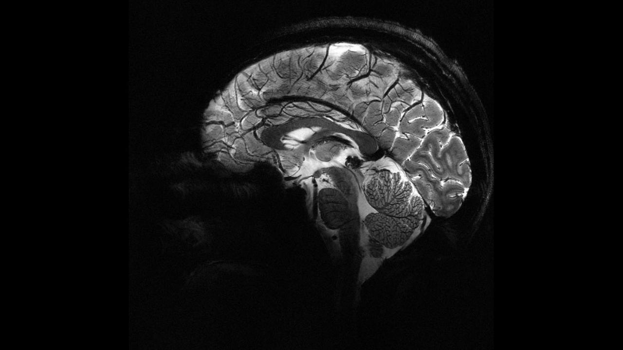 İnsan beyninin en güçlü MRI cihazıyla çekilen en net görüntüsü yayınlandı