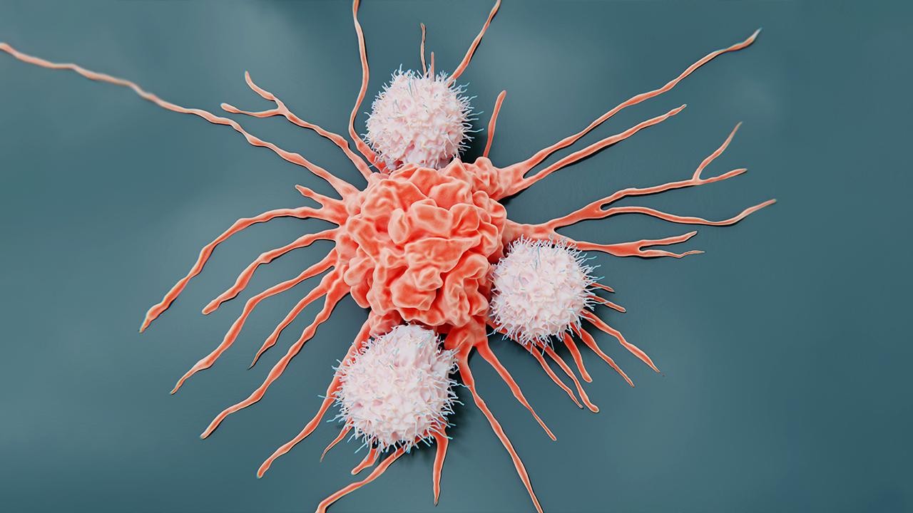 Kanser vakalarının 3’te 1’i önlenebilir: En çok görülen kanser türleri neler?