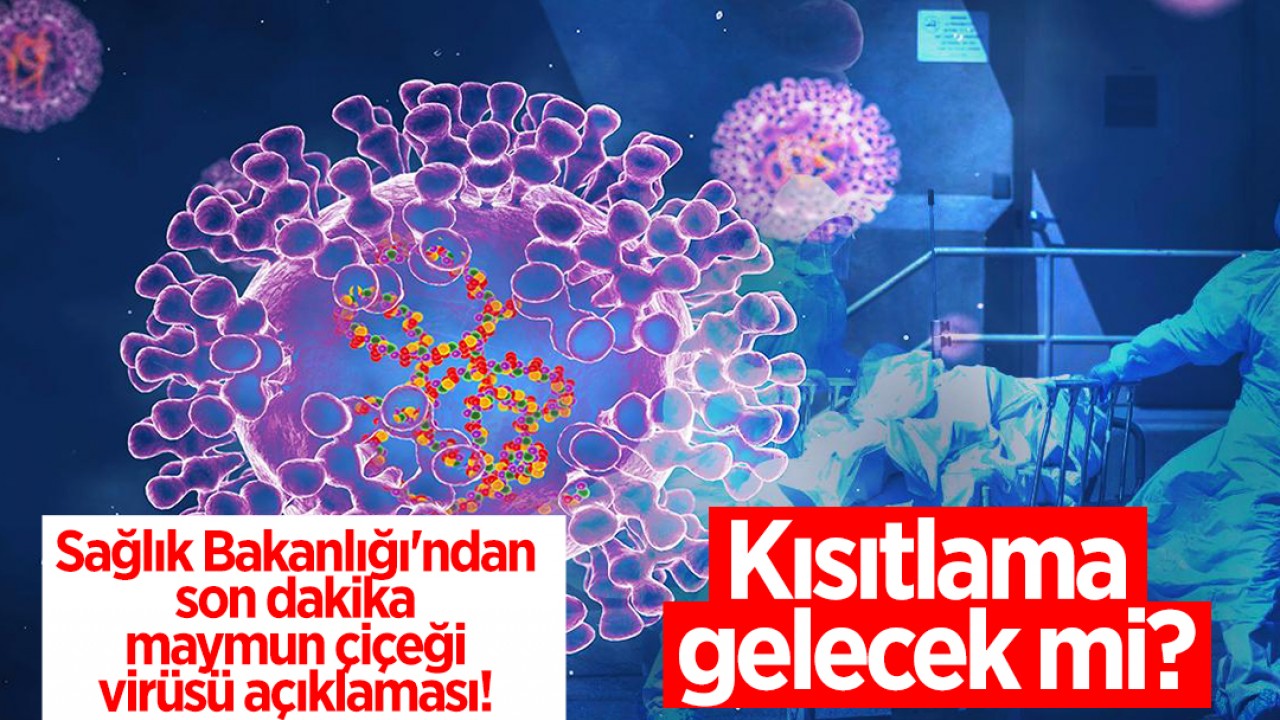 Sağlık Bakanlığı'ndan son dakika maymun çiçeği virüsü açıklaması! Kısıtlama gelecek mi?