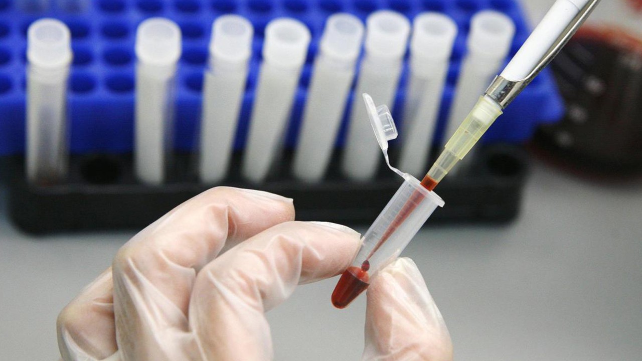 HIV olduğunu eşinden sakladı, 20 yıla kadar hapisle yargılanacak