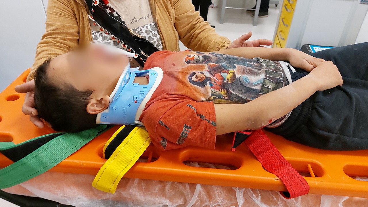 Köpekten kaçan çocuğa araç çarptı