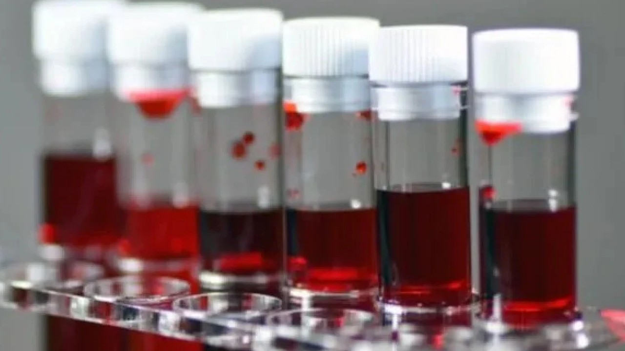 En sinirli kan grubu belli oldu