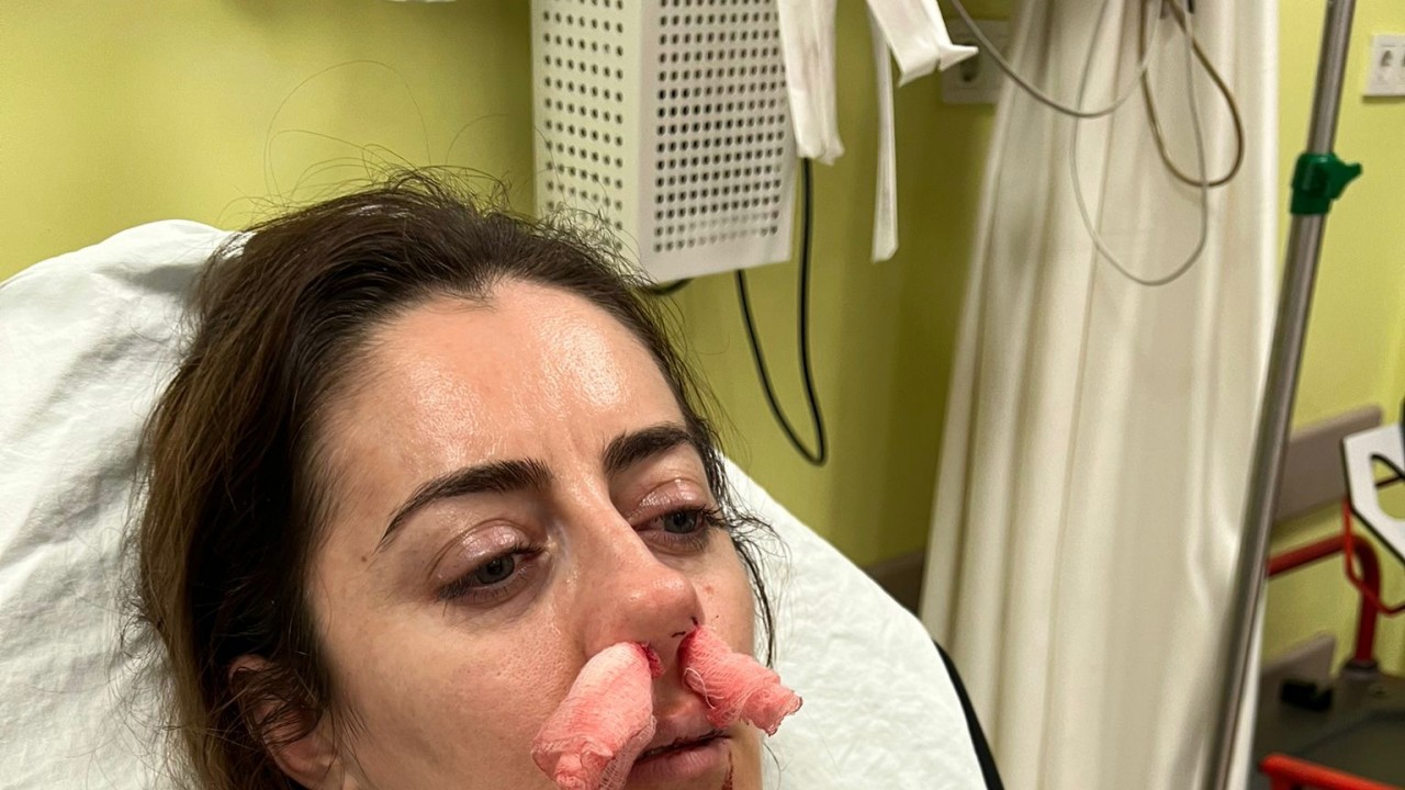 Kendisini eşinin kız arkadaşı zanneden kadın tarafından darbedildi