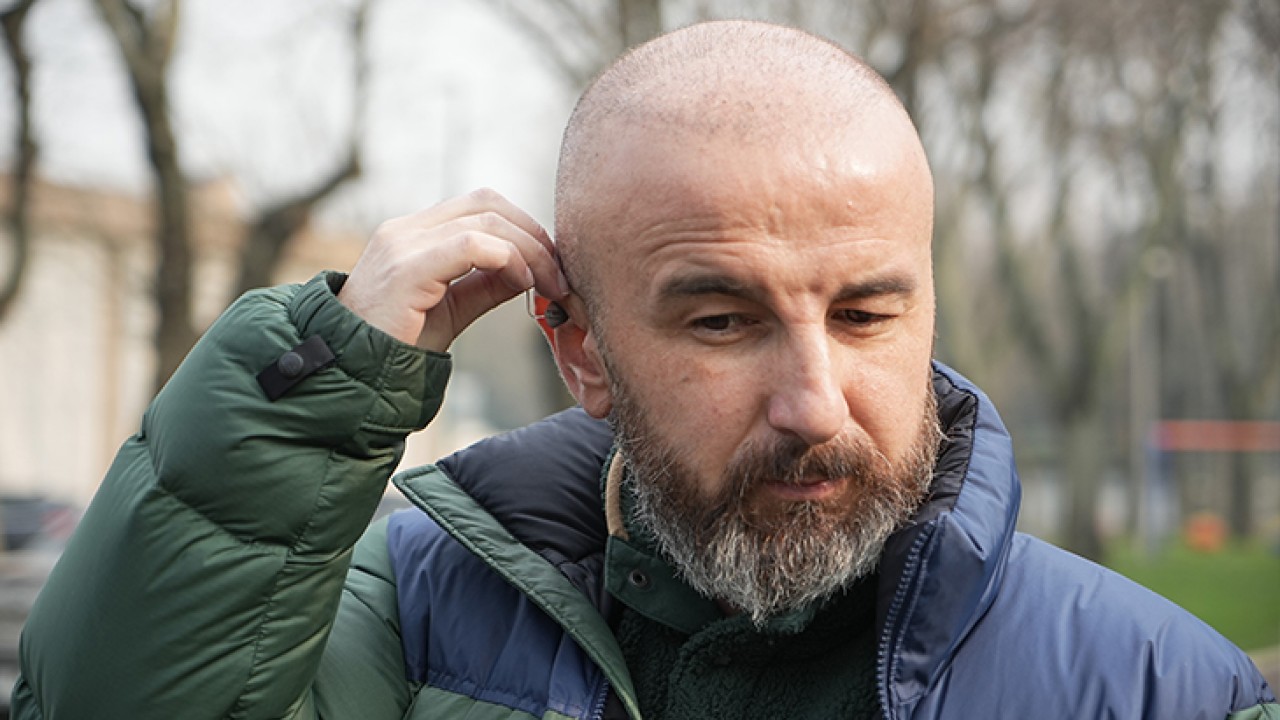 Saç ekerken kulak zarını biçti