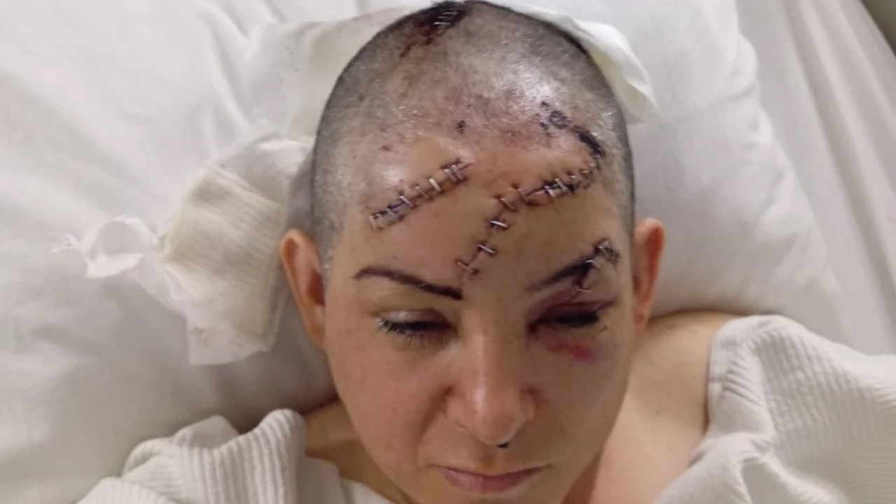 Çocuklarının gözü önünde eşinin satırla ağır yaraladığı kadın yaşadığı dehşeti anlattı