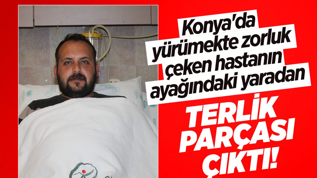 Konya'da yürümekte zorluk çeken hastanın ayağındaki yaradan terlik parçası çıktı