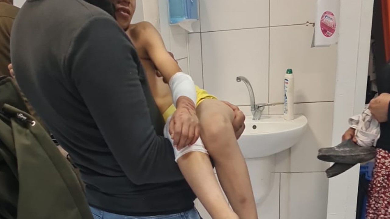 Sokakta oyun oynarken başıboş köpeklerin saldırısına uğrayan çocuk yaralandı