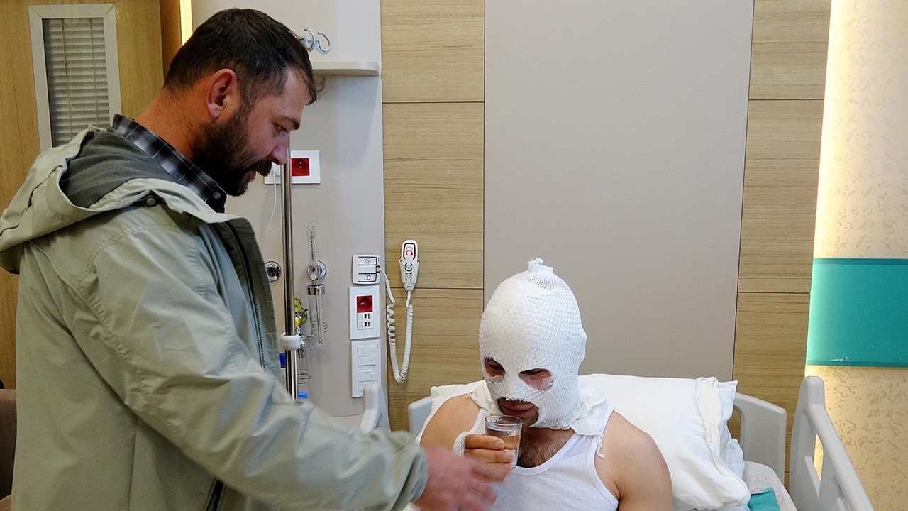 Nişanlısına hediye paketi hazırlarken patlayan sprey boya kutusu hastanelik etti