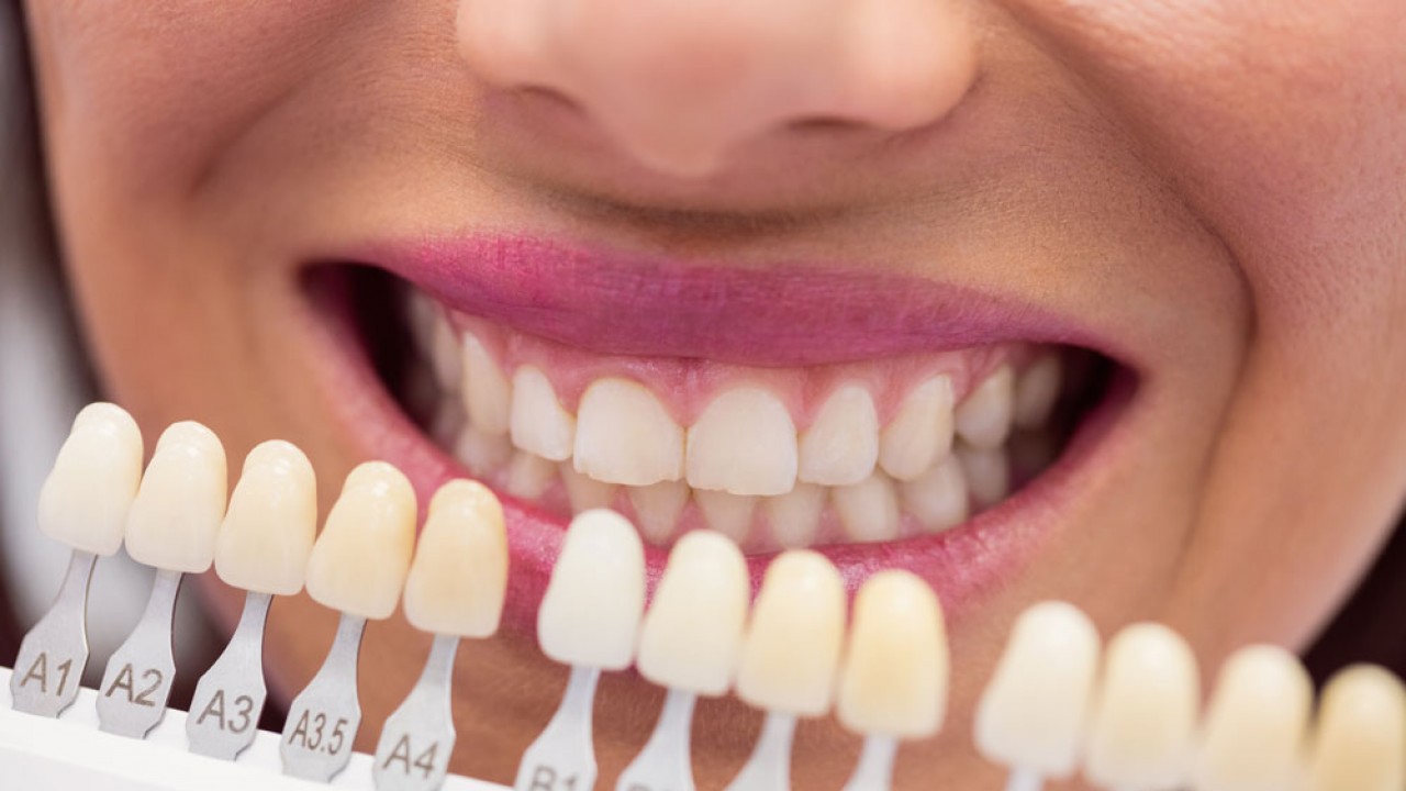 Zirkonyum kaplama nedir ve neden tercih edilir?