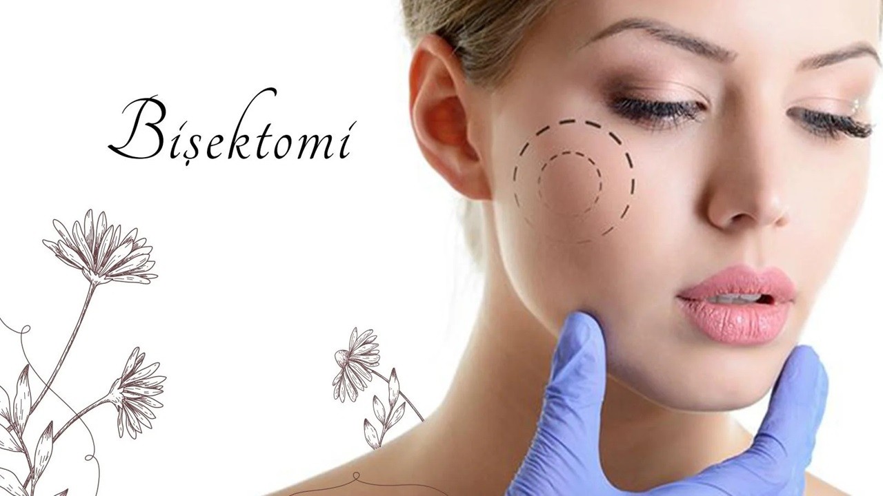 Yanak Yağlarına Elveda: Bişektomi Hakkında Merak Edilenler