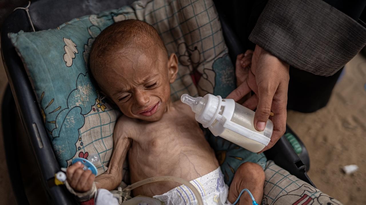 Katil İsrail'in yardım girişini engellediği Gazze'de 3 bin 500 çocuk açlıktan ölebilir