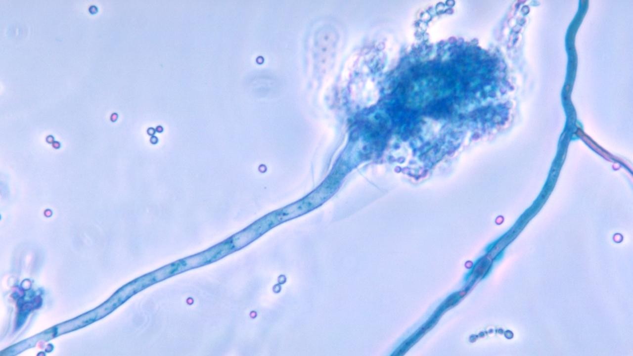 Ölümcül mantar hastalığı, küresel ısınmayla yayılabilir