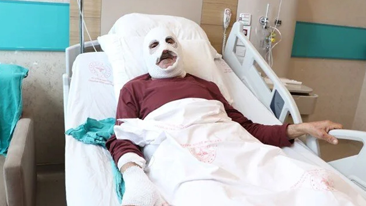 Çakmakla gaz kaçağını kontrol ederken dehşeti yaşadı