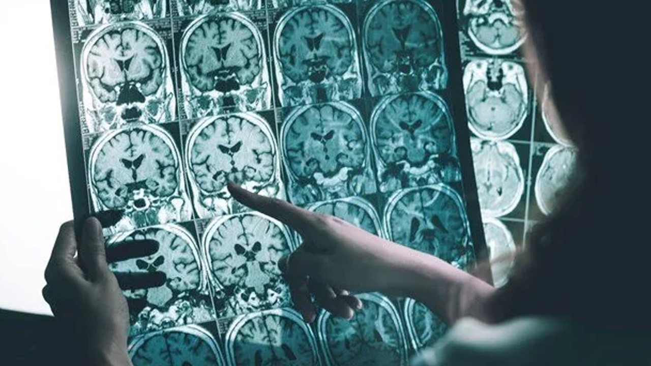 Stresli işlere karşı elektronik dövme: Fazla çalışınca alarm veriyor