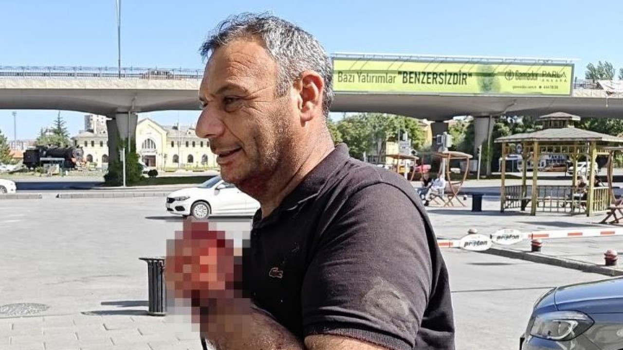 Acemi kasaplar soluğu acil serviste aldı