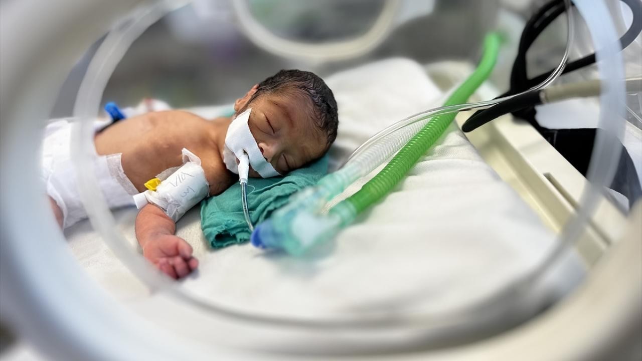 DSÖ: Gazze'de her gün ortalama 112 çocuk yetersiz beslenme nedeniyle hastaneye kaldırılıyor