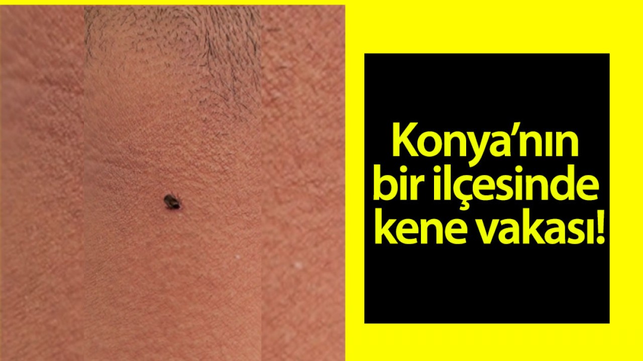 Konya’nın bir ilçesinde kene vakası!