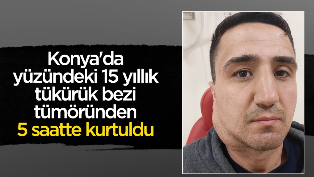 Konya’da yüzündeki 15 yıllık tükürük bezi tümöründen 5 saatte kurtuldu